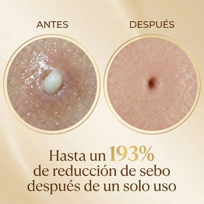 Tratamiento Borrador de Poros & Anti Manchas